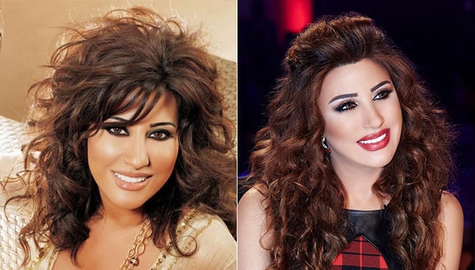 هل خضعت نجوى كرم لتكبير شفتيها؟