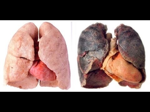 7 خطوات سهلة لتنقية رئتيك في 3 أيام!