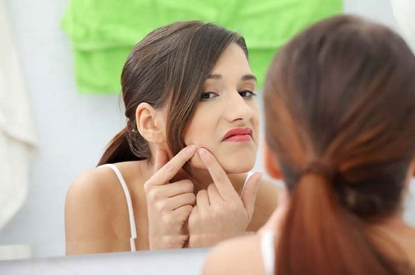 10 خطوات سهلة لتتخلّصي من حب الشباب نهائياً!