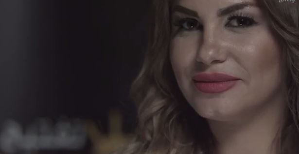 علاقة الشوكولا بحب الشباب خرافة أم واقع؟ الدكتورة نتالي تجيب