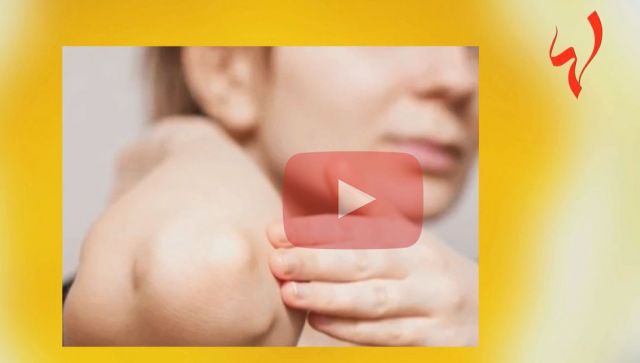 إسألي ماغي - إليك الطريقة الأسهل للتخلص نهائياً من اسمرار الكوعين!