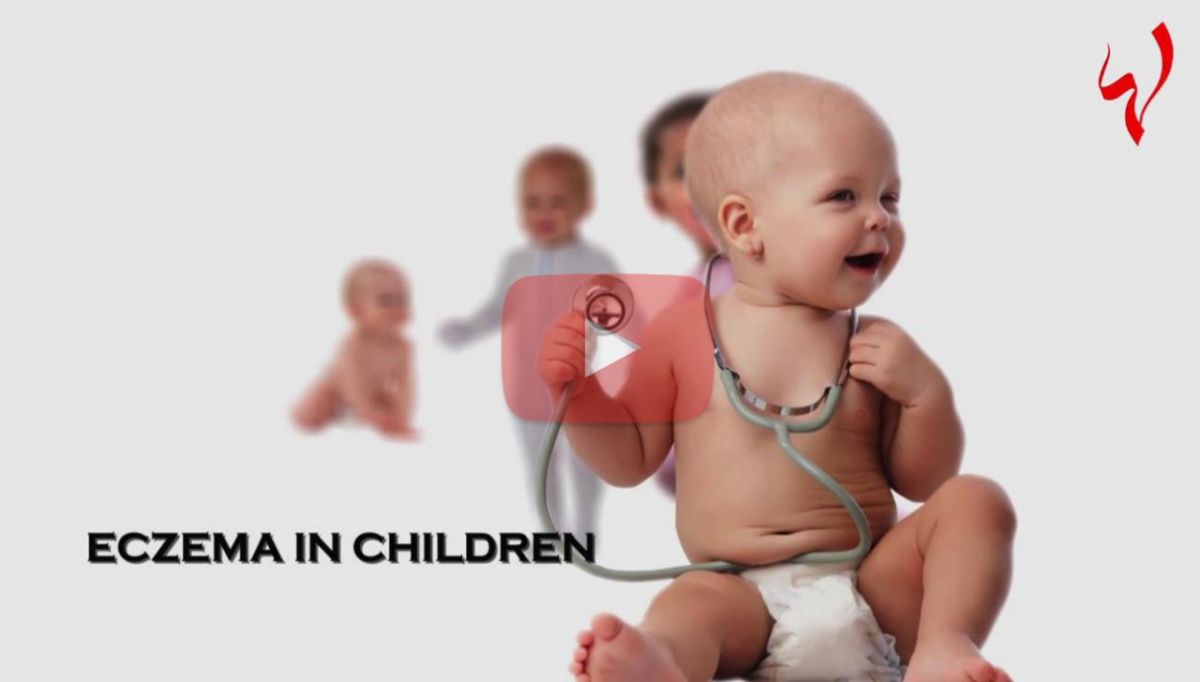 صحتك مع كارين - كيف تحمين طفلك من الإكزيما؟