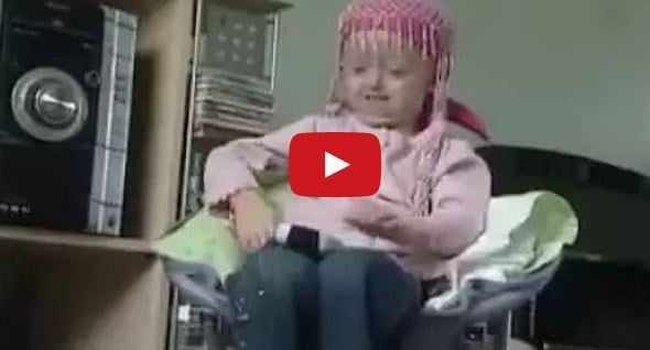 بالفيديو- وفاة الطفلة المعجزة بسبب شيخوختها المبكرة