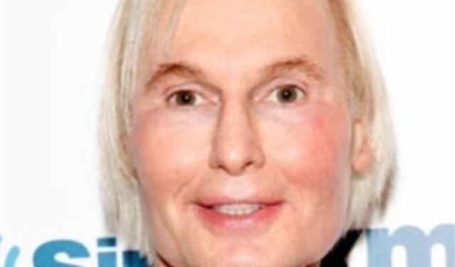 انتحار طبيب تجميل مادونا شنقاً والسبب صورة! شاهدوها