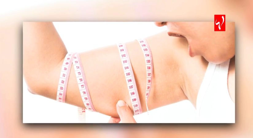 صحتك مع كارين - إليك أفضل الحلول للتخلص من السيلوليت