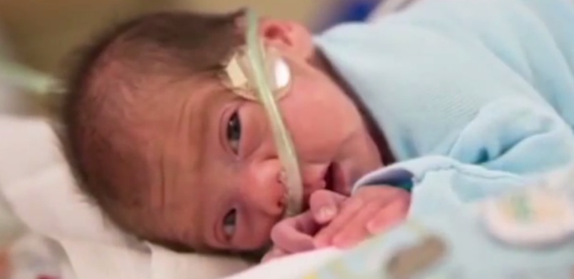 بالفيديو - ولادة رضيع من رحم أم متوفاة دماغياً