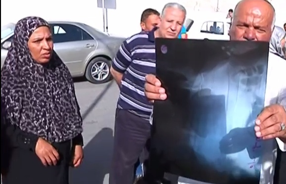 بالفيديو- هكذا ترك طبيب هاتفه الخلوي في بطن مريضته الأردنية!!