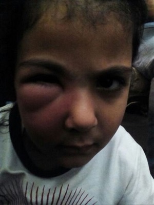 المدرّسة ضربت طفلة في 