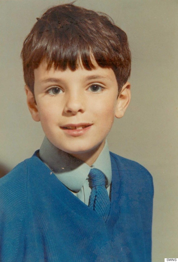 بالفيديو - يعطس فتخرج من أنفه قطعة ابتلعها منذ 44 عاماً