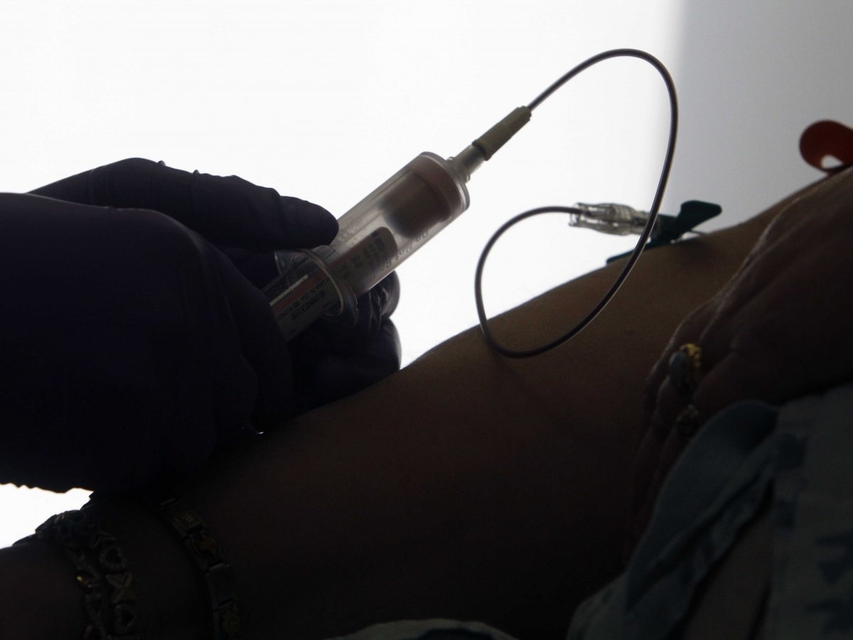 فحص دم جديد يغيّر علاج السرطان