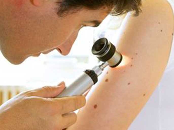 علاج جديد لسرطان الجلد