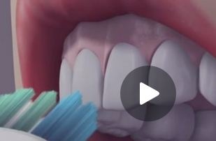 بالفيديو- هذه هي الطريقة الأمثل لتنظيف الاسنان بالفرشاة