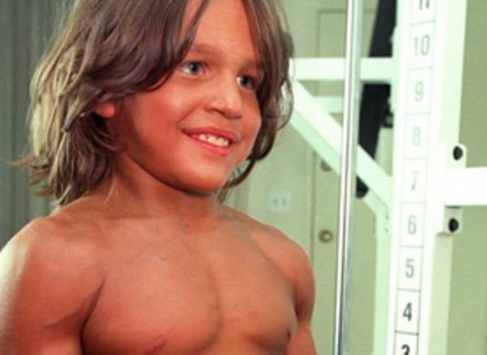 بالصور- ستصدمون... هكذا أصبح أقوى طفل في العالم عندما أصبح شاباً !