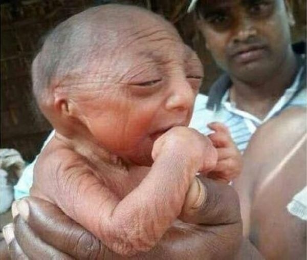 بالصورة- مولود غريب يقدر الأطباء عمره بـ110 سنوات