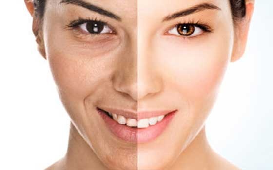 هكذا يمكنك تأخير ظهور تجاعيد البشرة والتمتع بمظهر شاب لأطول فترة!