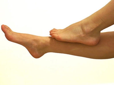 لا تهملي التشققات الجلدية