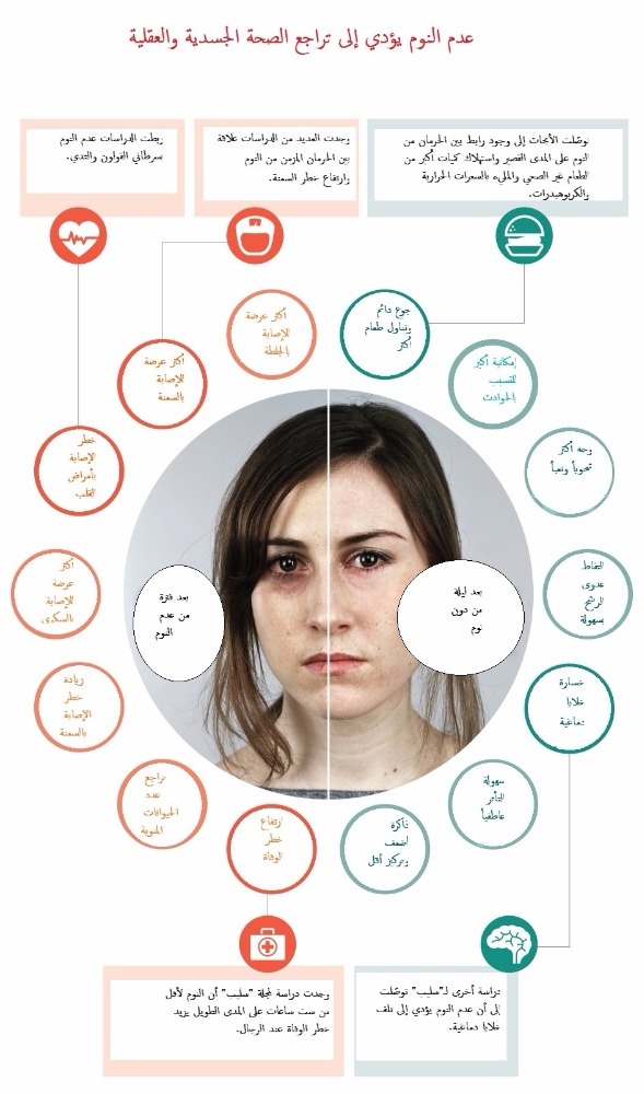 بالصورة - هذا ما يسببه عدم النوم لأجسامنا وعقولنا!