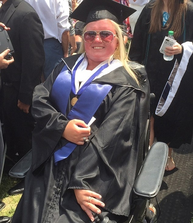 امرأة تتحوّل إلى تمثال حجري بسبب مرض نادر