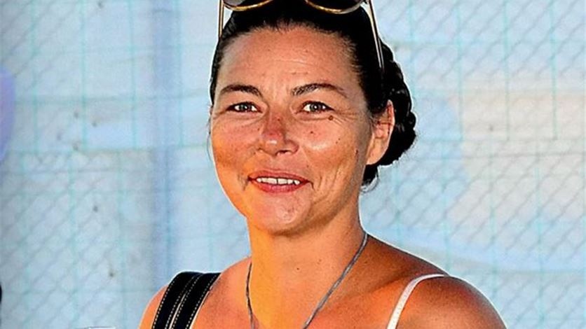 ابتلعت شقيقتها التوأم وحملت بها! إليكم ماذا حدث لها بعد 40 سنة