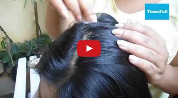 بالفيديو– كيفية استخدام عصير البصل لزيادة نمو الشعر