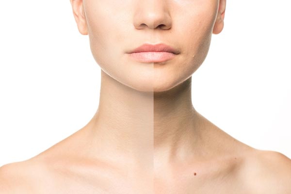 10 علاجات طبيعية للتخلص من التجاعيد