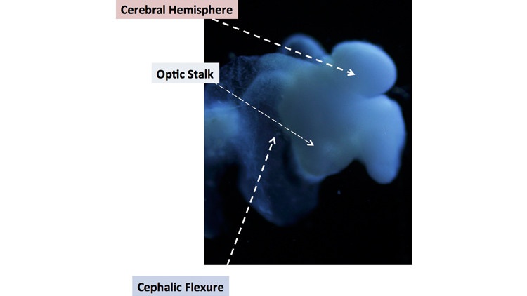 انماء دماغ بشري في المختبر لدراسته