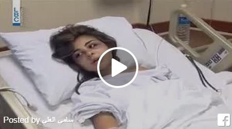 بالفيديو - لبناني يشوه وجه زوجته بسبب جمالها