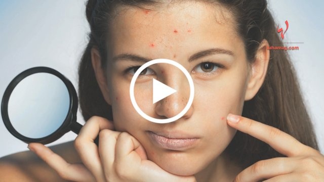 اسألي ماغي - نصائح عملية تعلّم المراهقات كيفية الاعتناء بالبشرة