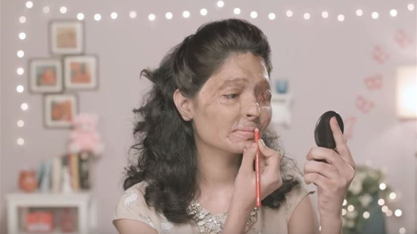 ضحيّة الأسيد الحارق تهزّ العالم بهذا الفيديو! ما قصتها؟