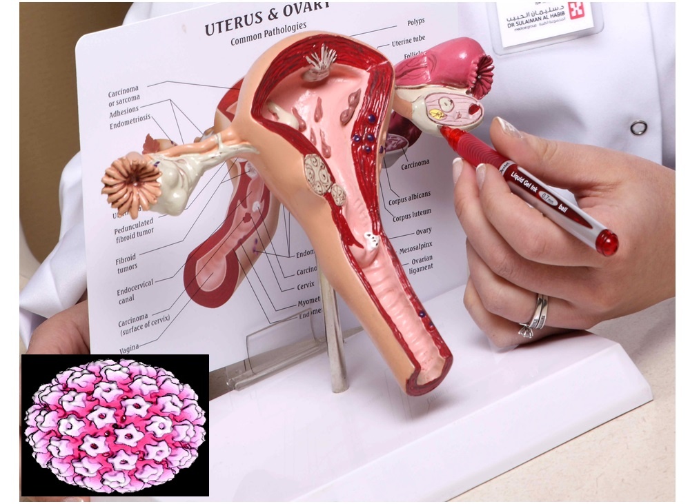 دلالات على إصابتك بسرطان عنق الرّحم.. احذري منها!