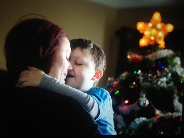 بالصور - قالوا إنه سيموت في العيد بسبب السرطان... شاهدوا ماذا فعل أهله