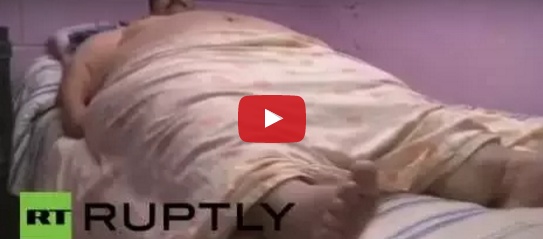 بالفيديو - أسمن رجل في العالم يخضع لعملية تصغير معدة