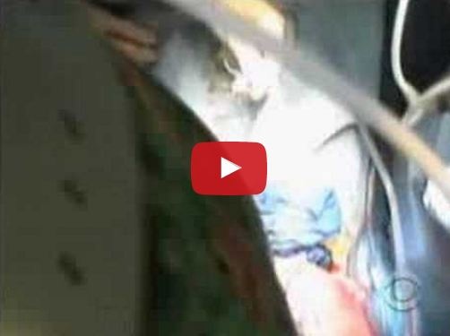 طفلة قالوا إنها معجزة لأنها ولدت مرتين! تحذير: الفيديو يحتوي مشاهد من غرفة العمليات