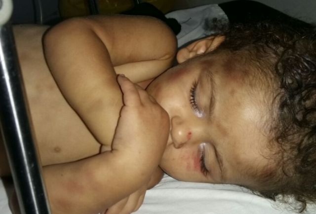 بالفيديو - طفلة سورية تنجو من همجية زوجة أبيها