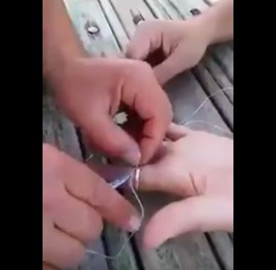 بالفيديو – طريقة مبتكرة لنزع خاتم ضيق من الإصبع