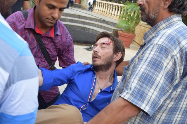 بالصور - حقيقة الإصابة الخطيرة التي تعرض لها أحمد زاهر