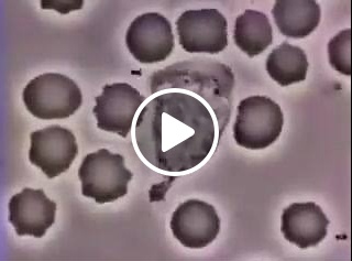 بالفيديو - شاهدوا كيف تنقض خلايا الدم البيضاء على البكتيريا في 28 ثانية