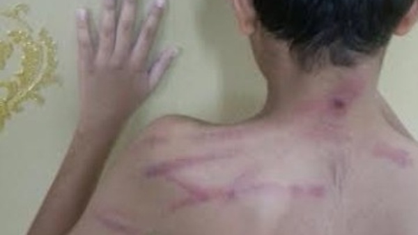 أخيراً صدر القرار بحق المعلم الذي ضرب طالباً بـ 