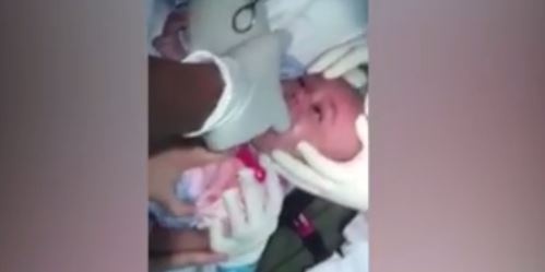 بالفيديو - استخراج ساعة علقت في حلق رضيع!