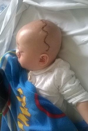 بالصور - طفل ولد بحالة نادرة.. وأمه لقّبته بـ