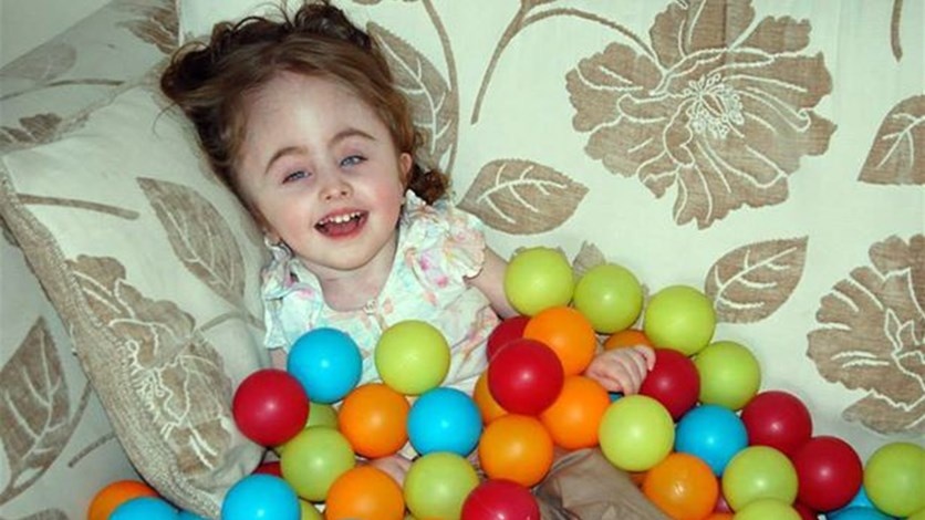 بالصور – حالة نادرة لطفلة بجسم طبيعي ورأس امرأة!