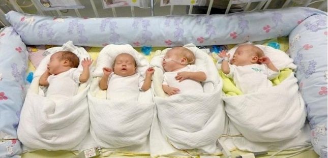 حالة نادرة - إمرأة تنجب اثنين من التوائم المتطابقة