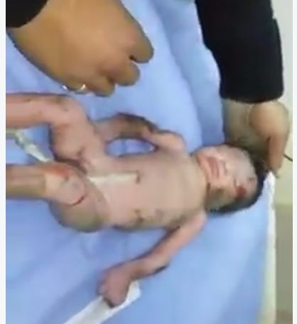 فيديو غير مناسب لذوي القلوب الضعيفة - أم ترمي رضيعها من شباك غرفة الولادة... شاهدوا ماذا فعل الشاب الذي سقط على رأسه