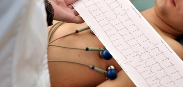 أهم 10 نصائح لتفادي الموت المفاجئ أثناء الرياضة أو المجهود الكبير