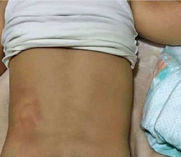 دور حضانة «تعتدي» على رُضّع! أم شريكة؟ومديرة متورّطة