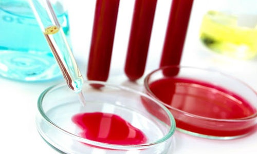 فحص الدم خاص يكتشف عمرك الحقيقي!!