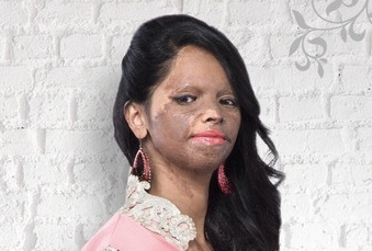 بالصور - فتاة مشوّهة بالأسيد.. وجه إعلاني لماركة أزياء عالمية