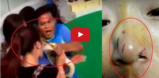 بالفيديو - شاهدوا أفعى تهاجم فتاة في وجهها مباشرة