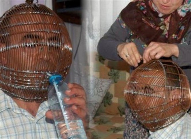 زوجة تجبر زوجها على العيش ورأسه بقفص حديدي... والسبب؟