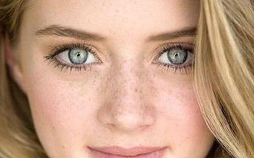 3 طرق طبيعية للتخلص من النمش والبقع الداكنة من الوجه.. جربوها